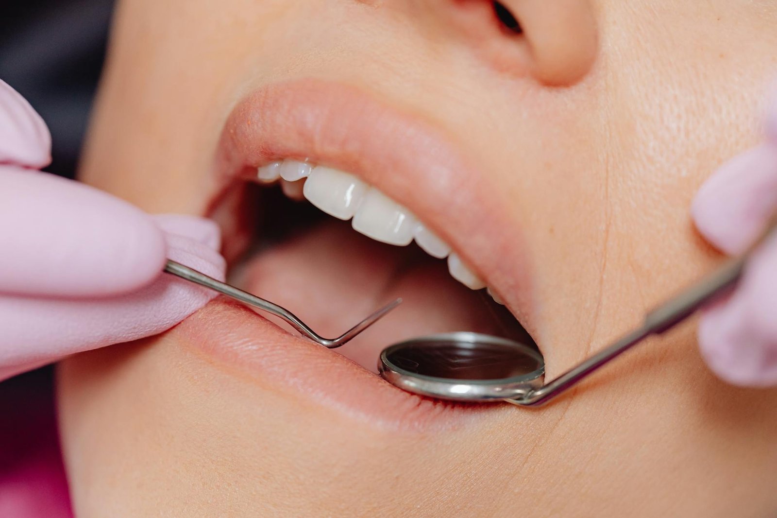Oral Cancer Awareness: Signs, Symptoms, and Prevention